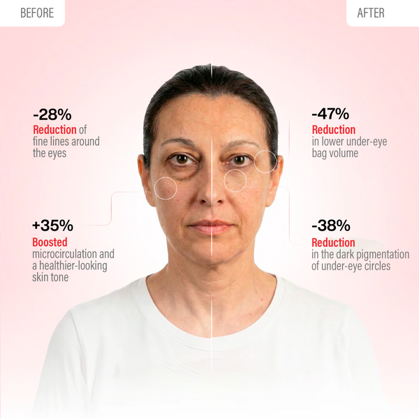 KireiEyes® 2-in-1 Rotlichttherapie + EMS zur Entfernung von Tränensäcken